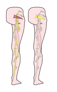 piriformis sciatic nerve