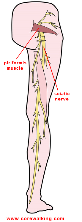 Sciatic Nerve Pain Relief Begs For Good Posture.