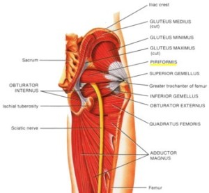 piriformis syndrome