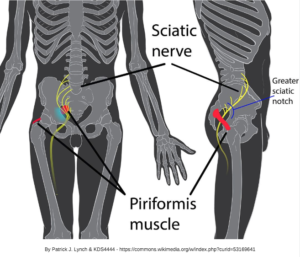 Piriformis Syndrome and the Sacroiliac Joint