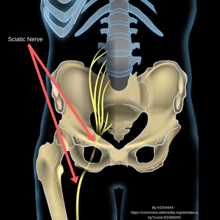 Piriformis Syndrome And The Sacroiliac Joint