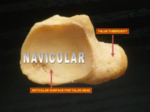 the_Navicular_bone_-_posterior_view