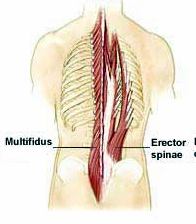 lower back muscles: multifidus and erector spinea
