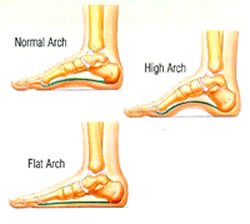 low arch vs high arch feet