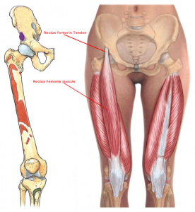 rectus femoris tendon
