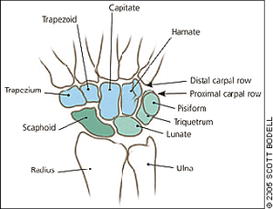 carpal tunnel pain is easily avoided with good posture