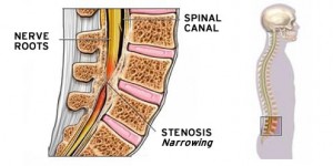 The lumbar curve of the spine