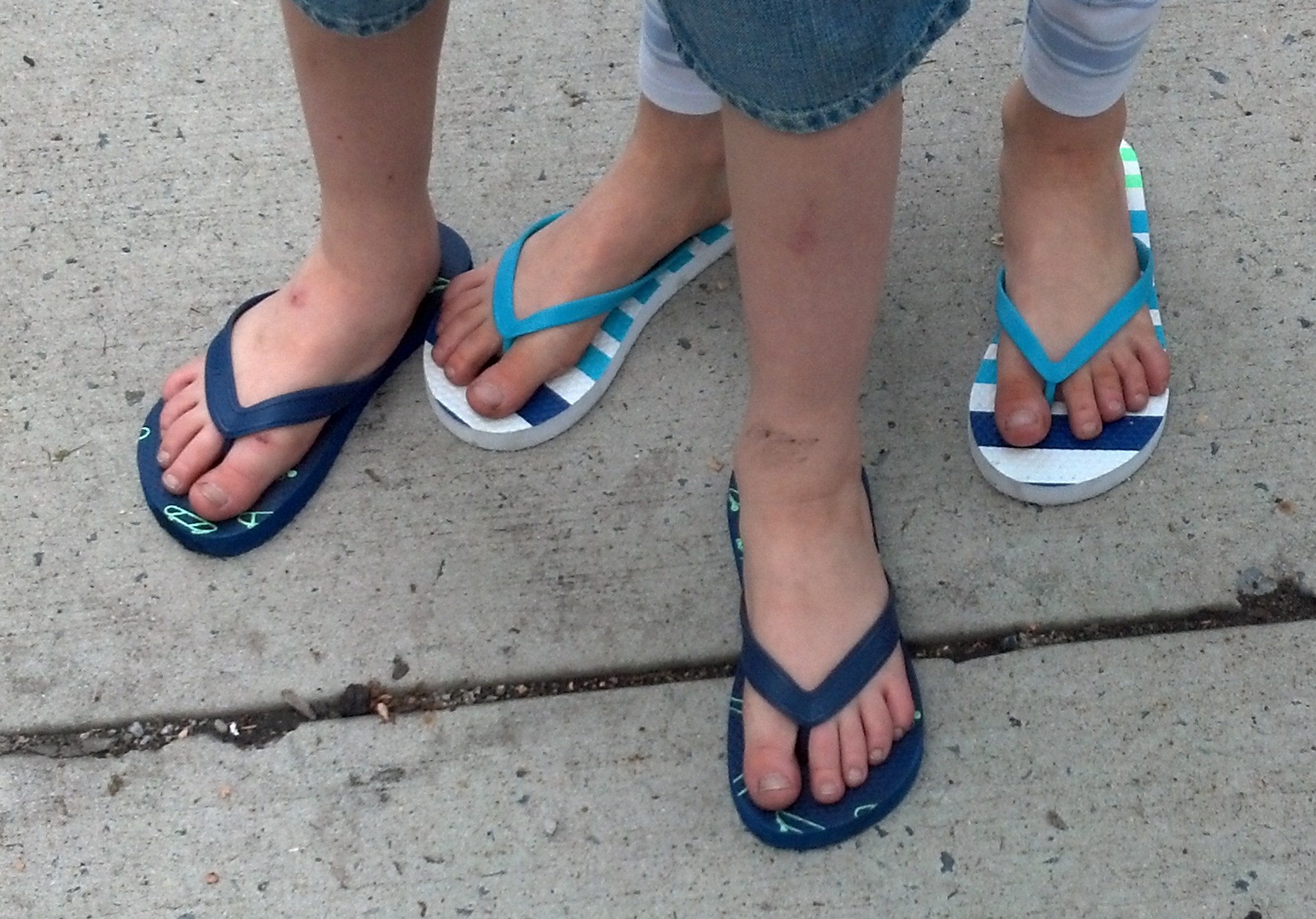 How To Get Rid Of Bad Smell In Flip Flops