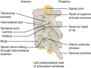 spinal stenosis