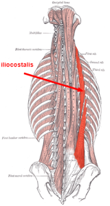 erector spinae muscles