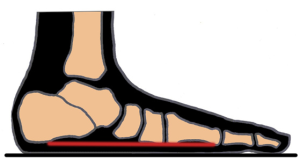 flat feet