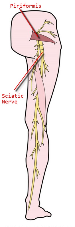 labelled sciatic nerve | CoreWalking