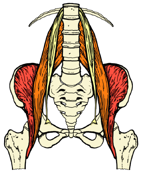 double sided Psoas