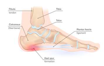 Plantar Fasciitis & The Pain In Your Foot | CoreWalking